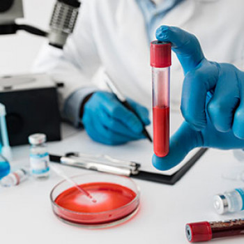 Lab test Image