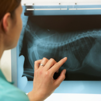 Bone Density Scan (DEXA)