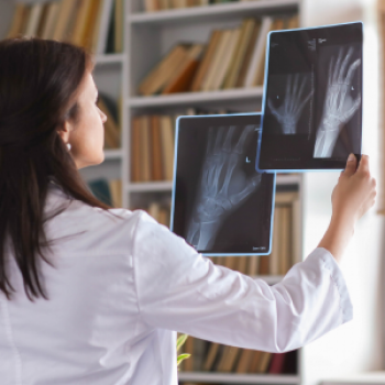 X-Ray (Radiography)